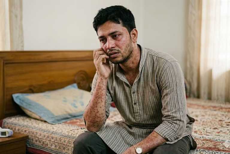 হাম কি বড়দেরও হতে পারে? হলে যা করবেন