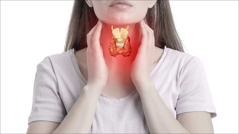 thyroid2_20240117_172308935