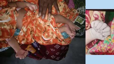 আ_ঠাশআঙুলেরশিশু-364859-720×405