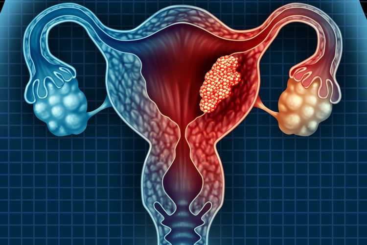 1606327740_5fbe9dbc0deb4_uterus