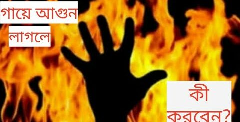 গায়ে আগুন লাগলে কী করবেন? Burn Tips || Dr Gabinda || DMC || Munni || Anannya Online Channel