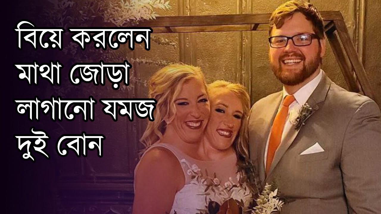 বিয়ে করলেন মাথা জোড়া লাগানো যমজ দুই বোন | Twin Sister