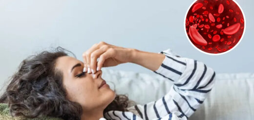 নারীদের রক্তশূন্যতা কেন বেশি হয়?