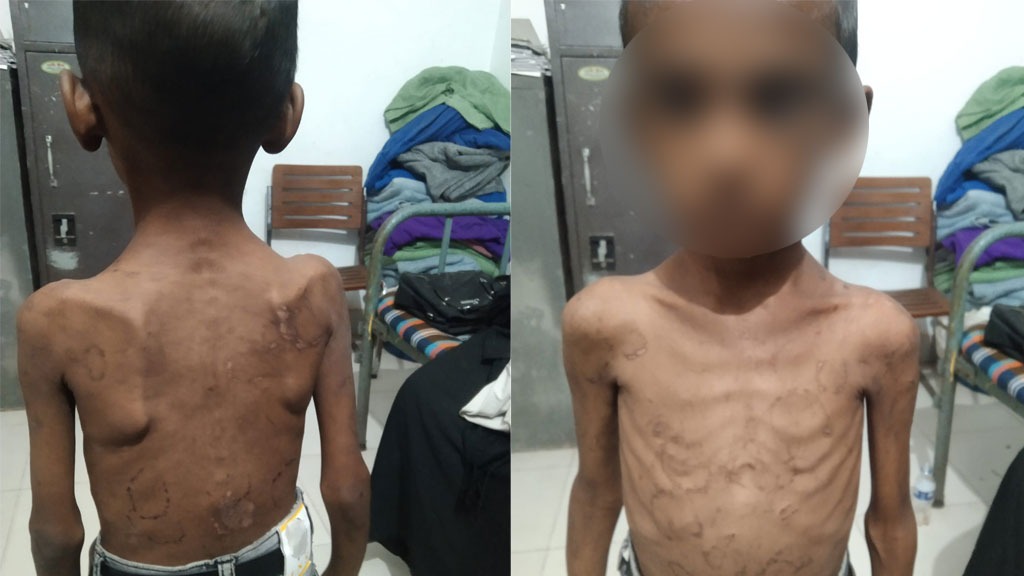 অপহরণ করে শিশু সোয়াইবকে ভিক্ষা করানো হয় প্রতিবন্ধী বানিয়ে